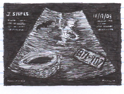 jspears101908 Jamie Lynn Spears Pregnant - Sonogram