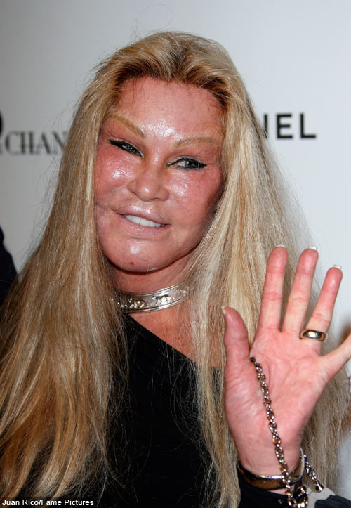 jocelyn wildenstein before surgery. next Jocelyn Wildenstein?