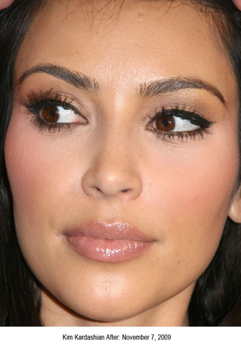 kim kardashian plastic surgery before and after pictures. Kim Kardashian has a
