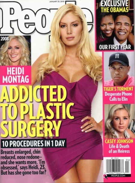 heidi montag before and after 10 surgeries. heidimontag