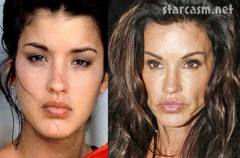 Janice Dickinson before and after plastic surgery? (image hosted by starcasm.net)