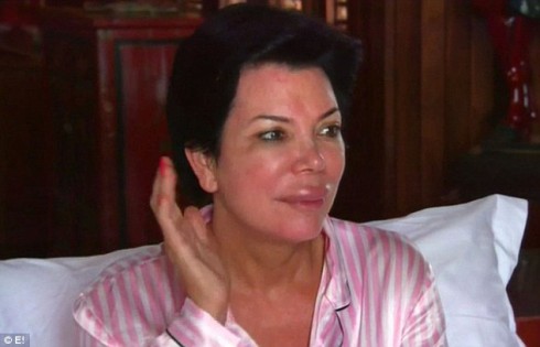 Kris Jenner lip injections