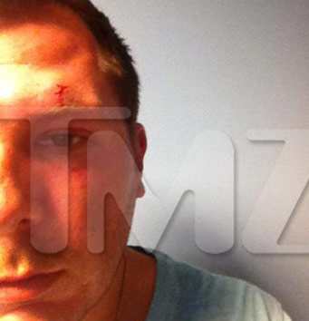 Justin Viterito injury Alleged Jersey Shore brawl victim Justin Viterito's injury