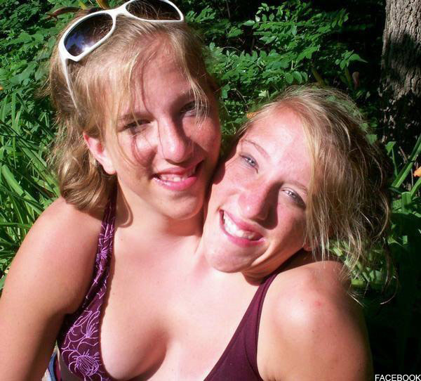 VIDEOS Conjoined twins Abigail and Brittany Hensel to star on TLC