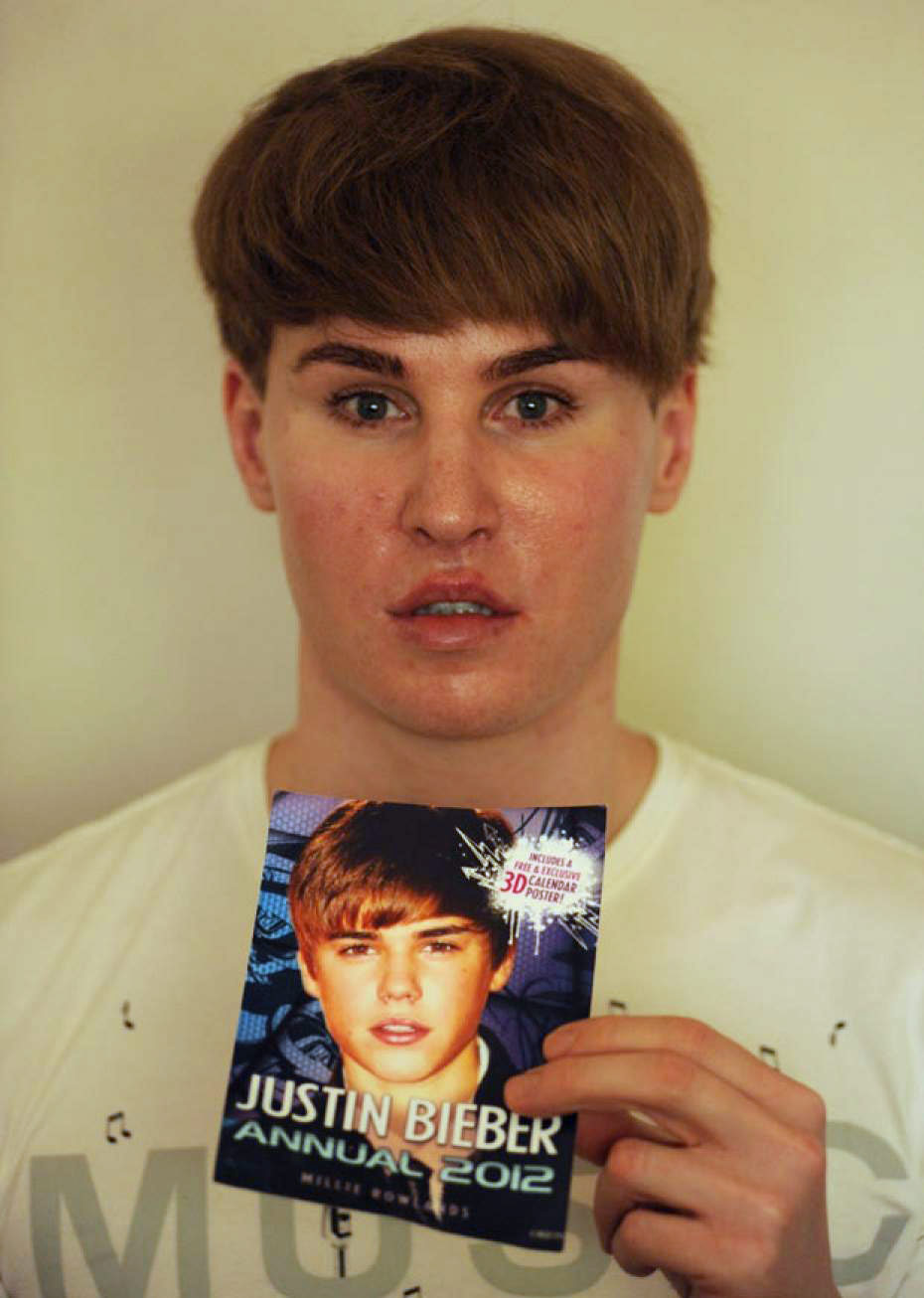Toby Sheldon gets plastic surgery to look like Justin Bieber - Toby_Sheldon_Justin_Bieber_lookalike_