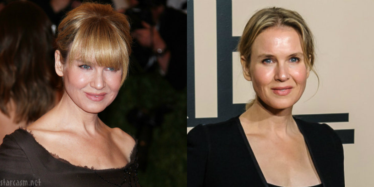 BEFORE & AFTER Did Renee Zellweger have plastic surgery?