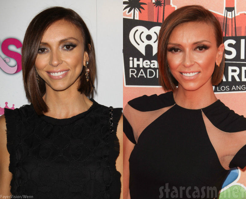 BEFORE & AFTER Did Giuliana Rancic get a facelift? Plastic