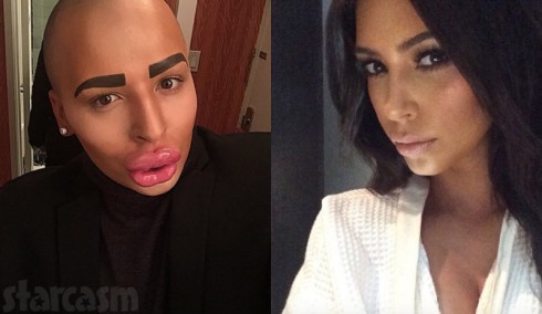 Jordan Parke plastic surgery to look like Kim Kardashian