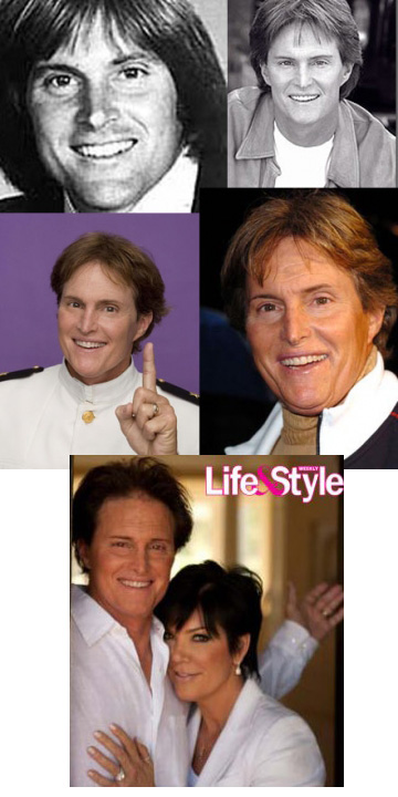 Bruce Jenner before and after plastic surgery photos