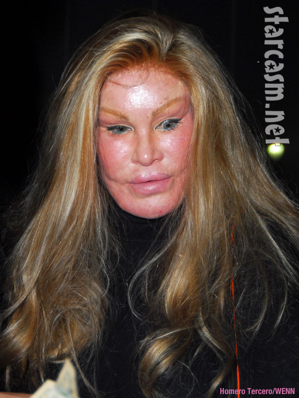 cat woman plastic surgery to look a like