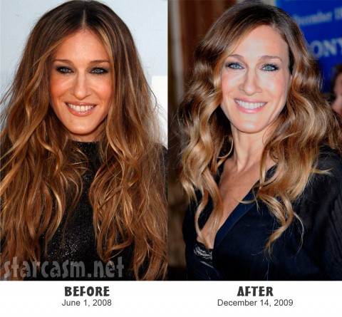Before and After photos of Sarah Jessica Parker's mole removal