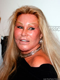 Jocelyn Wildenstein