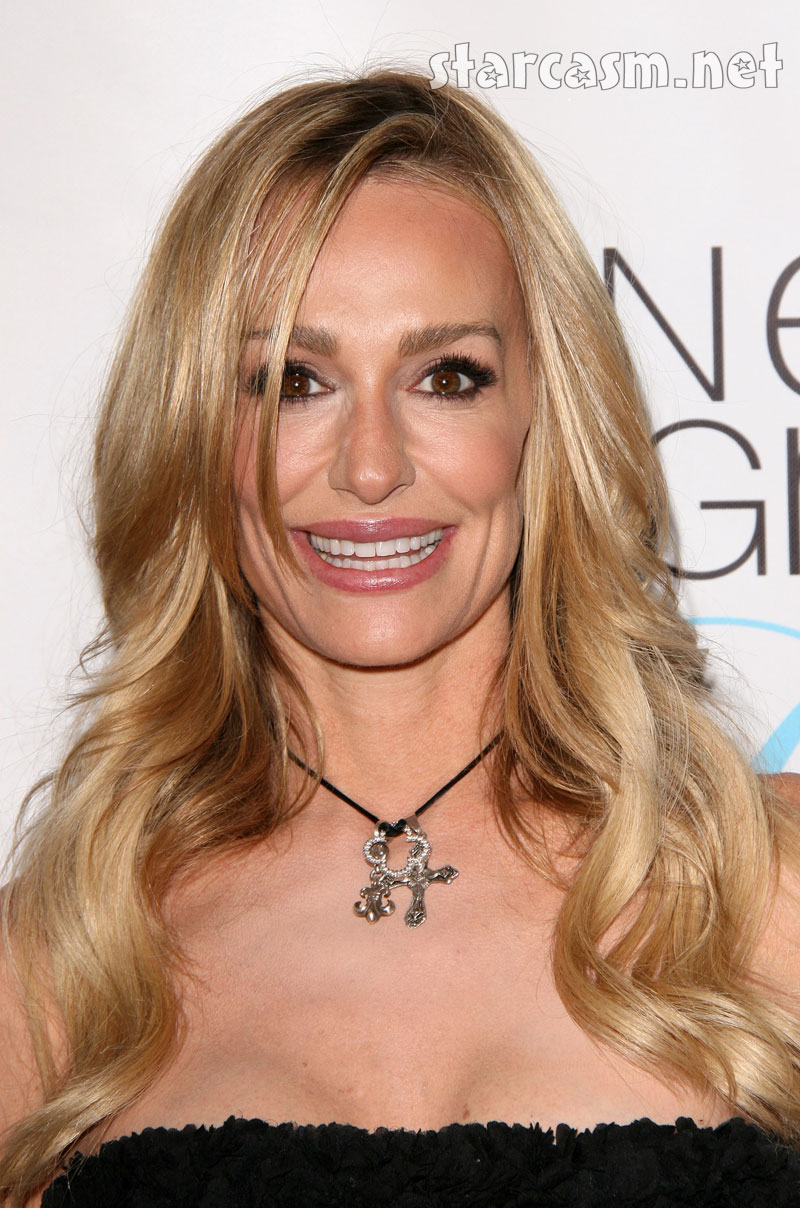 Taylor Armstrong plastic surgery, lip injections?