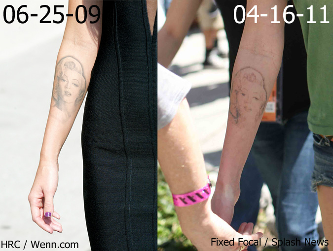 Megan Fox getting Marilyn Monroe tattoo removed Before & after