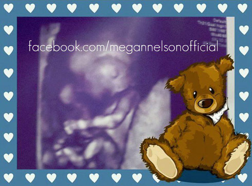 Ultrasound of Megan Nelson's baby boy Little Huckleberry