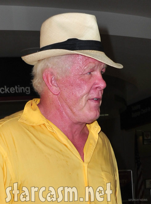 Nick Nolte red faced with a severe sunburn at LAX