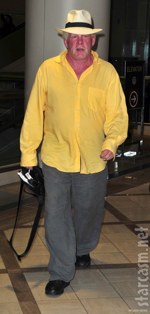 A severely sunburned Nick Nolte arrives at LAX