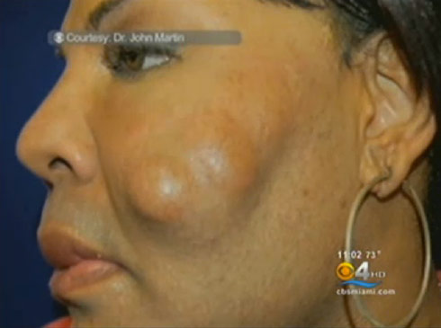 Oneal Morris patient Rajee Narinesingh picture