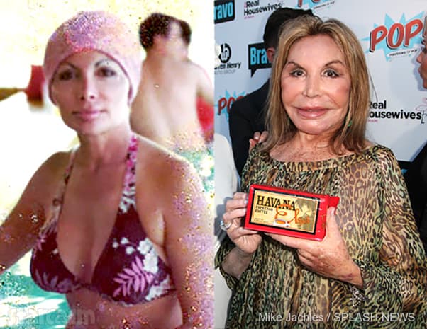 More Mama Elsa Patton before plastic surgery photos