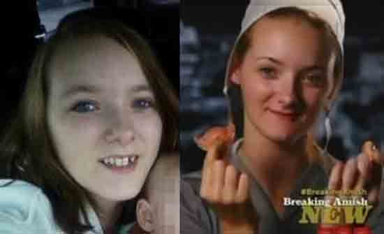 Breaking Amish Why Did Rebecca Lose Her Teeth At 19 Before And.