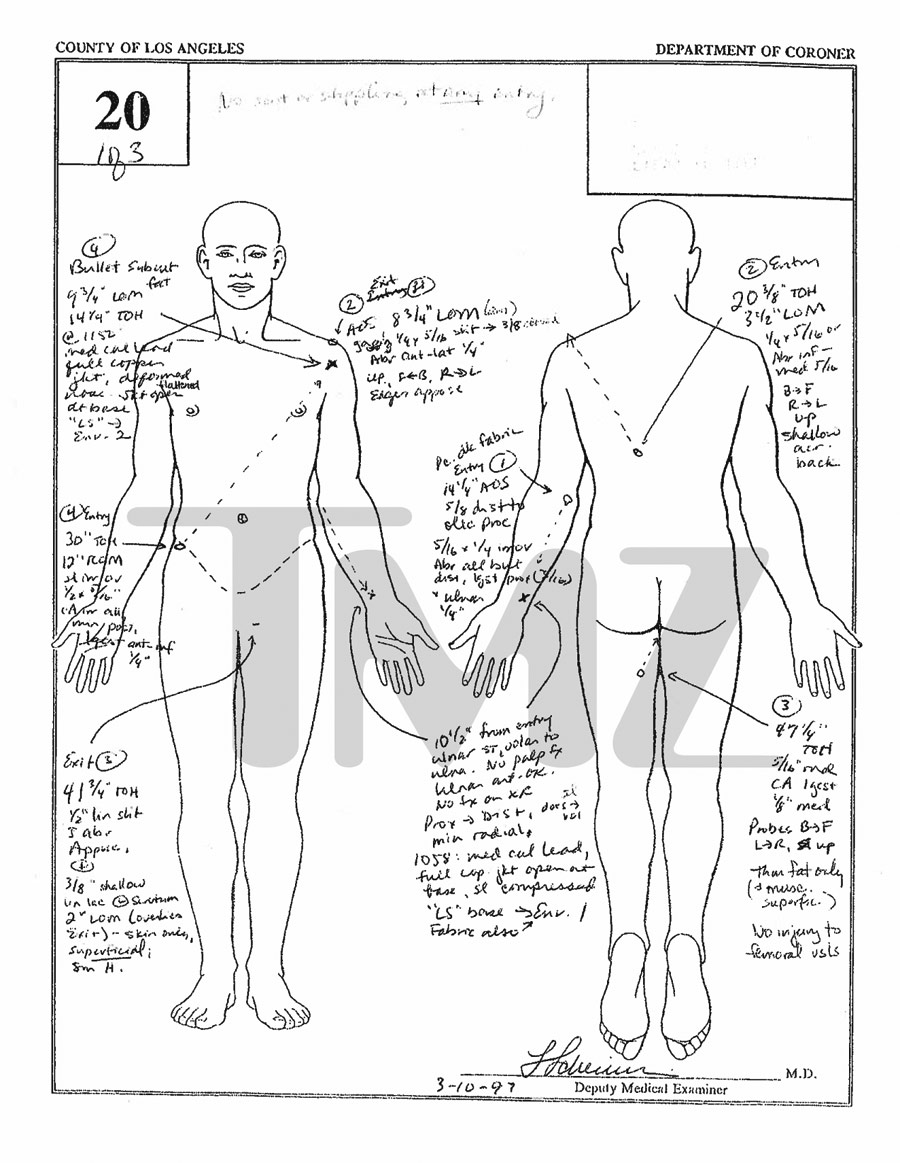 Notorious biggie autopsy