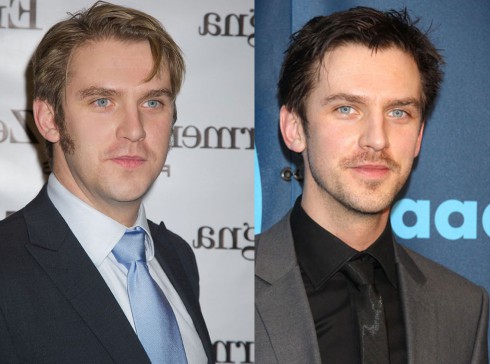 danstevensbeforeandafter