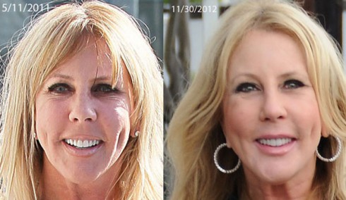 vickibeforeandafter vickibeforeandafter