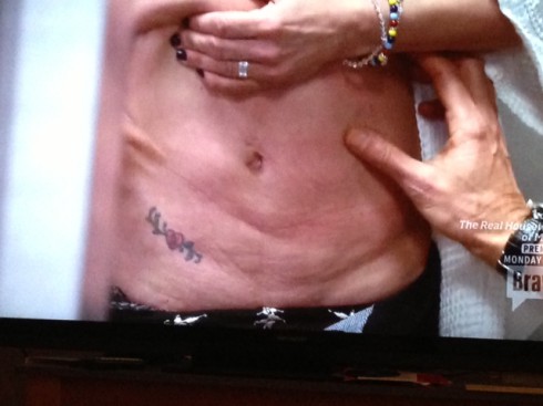 belly