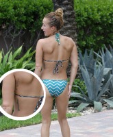 Hayden Panettiere’s laser removing her misspelled “live without regrets” tattoo