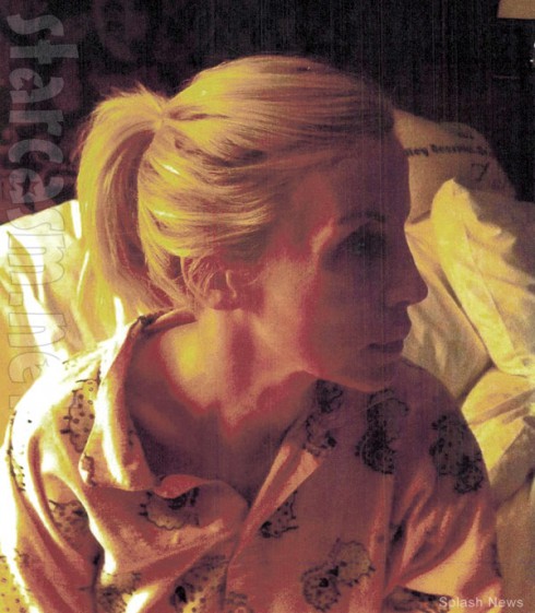 Camille Grammer injury photo after alleged boyfriend attack in Houston hospital