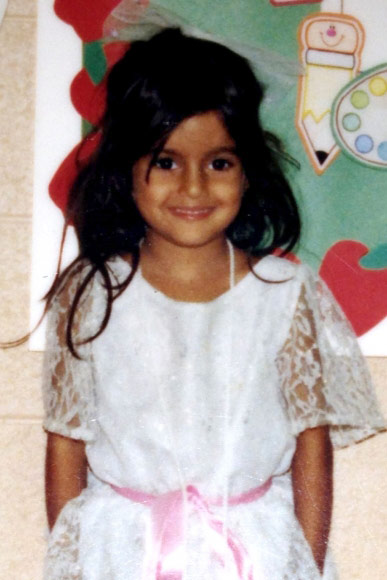 lilly ghalichi before plastic surgery