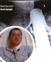 PHOTOS Tree trimmer James Valentine gets chainsaw in neck after job-gone-wrong