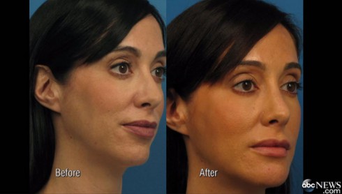 beforeandafter2