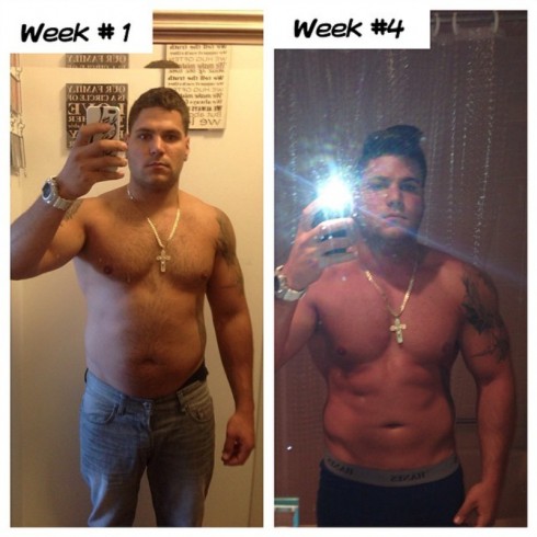 Jersey Shore Ronnie Magro Before and After