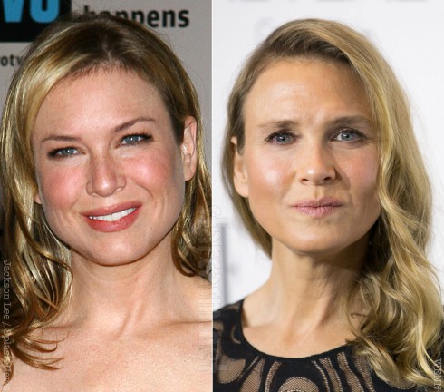 Renee Zellweger calls plastic surgery rumors a nefarious truth