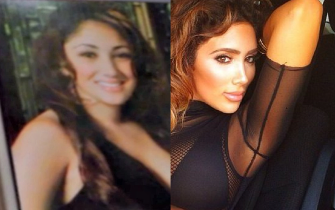 Jan 18, 2015 - nikki mudarris plastic surgery before and after photos. 