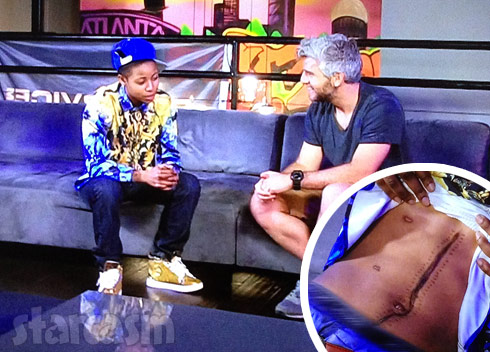 PHOTO UPDATE Catfish’s Dee Pimpin got shot!