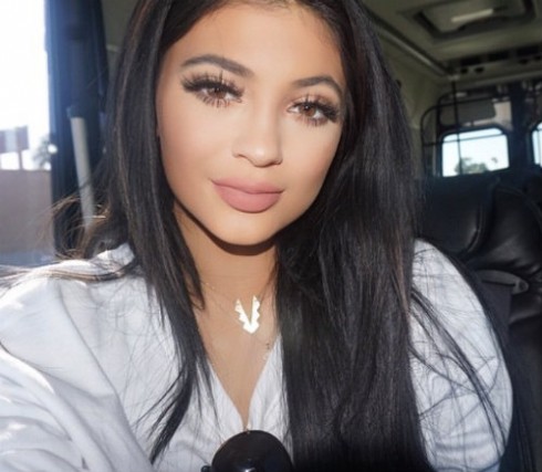 Were Kylie Jenner's lips plumped with plastic surgery?