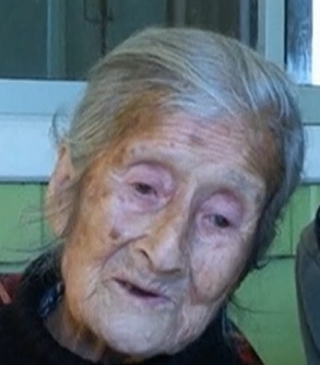 PHOTOS Doctors discover 75-year-old fetus in 92-year-old woman