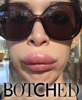 Farrah Abraham filming Teen Mom? On Botched Sunday, launching Fotched lipstick, more