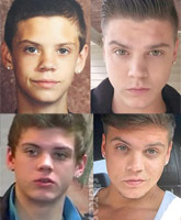 PHOTOS Did Tyler Baltierra have plastic surgery on his ears?