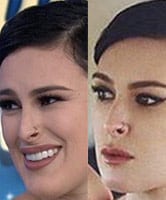 Rumer Willis calls Photoshopped image of jaw a form of bullying