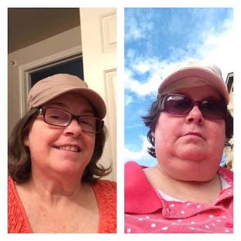 PHOTOS My 600 Lb Life's Diana Bunch has lost a ton more weight