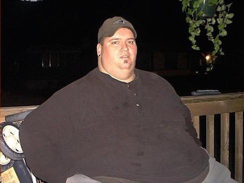 MY 600 LB LIFE Donald Shelton update and before and after pics