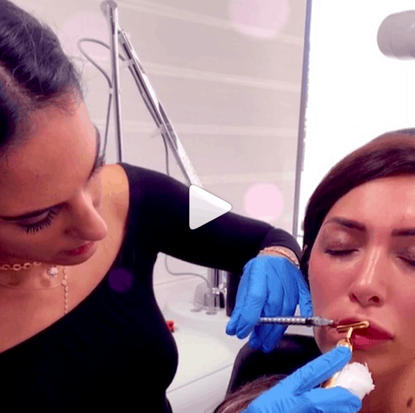 Farrah Abraham got her lip fillers removed