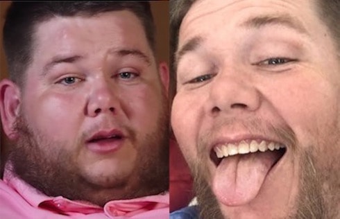 MY 600 LB LIFE Randy Statum remade in new before and after photos
