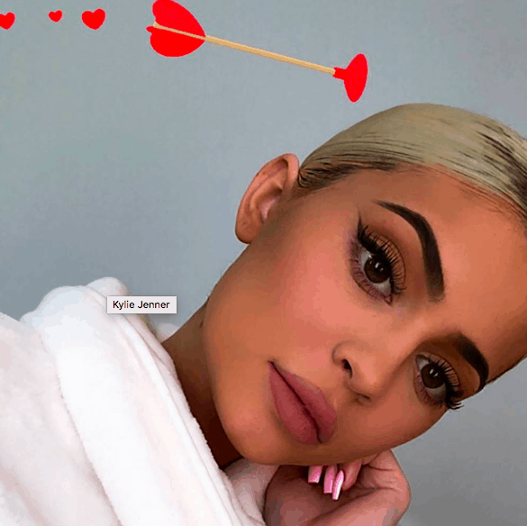 Why did Kylie Jenner get lip fillers again?