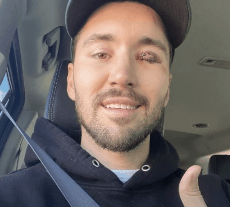 What happened to Jeff Wittek’s eye?