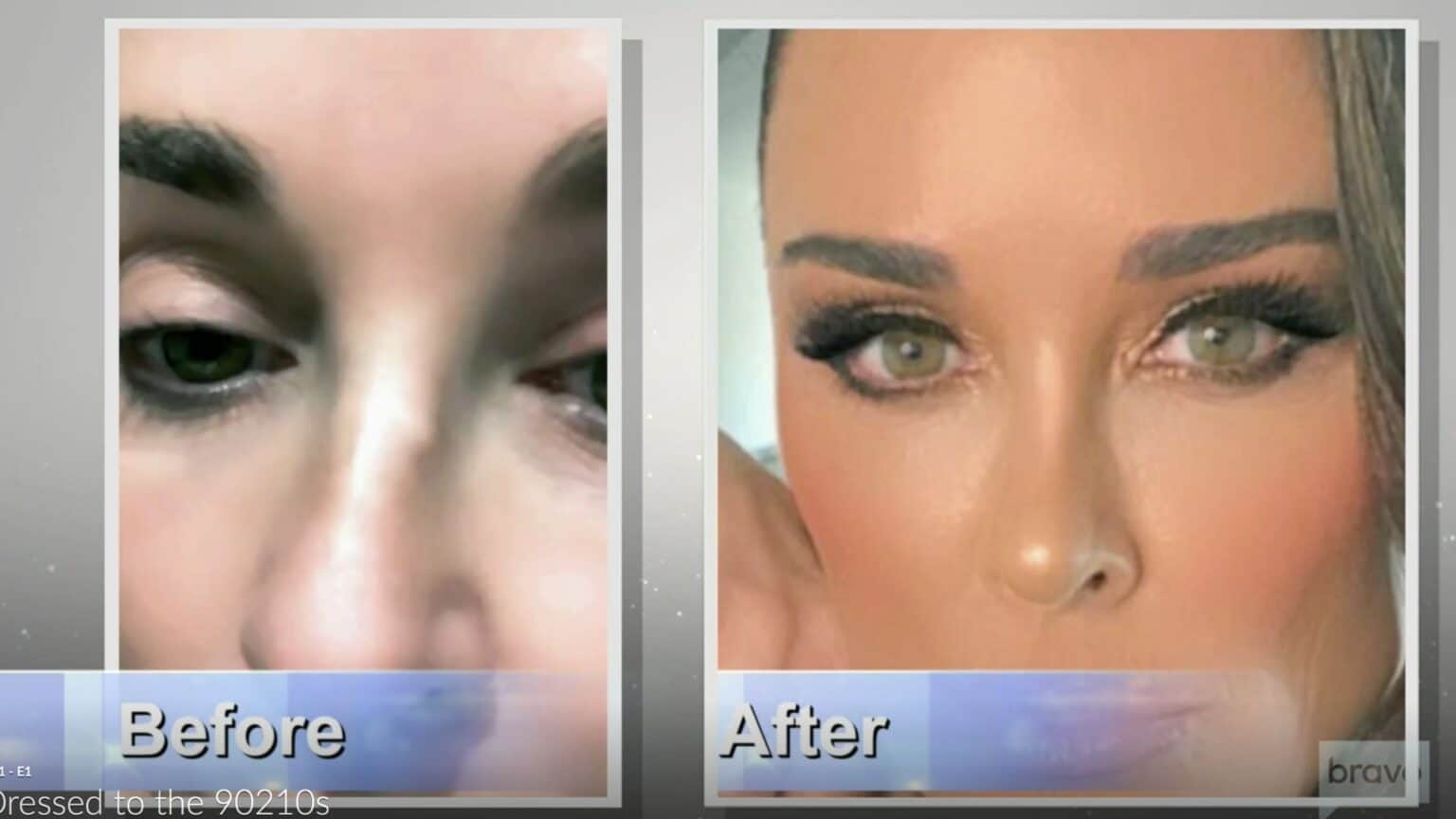 RHOBH Why Kyle Richards got a nose job: Before and after photos