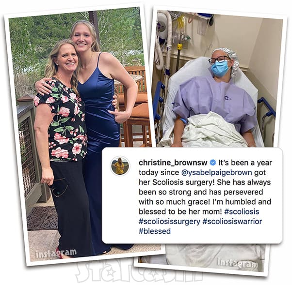 Sister Wives Christine's daughter Ysabel_scoliosis surgery update Sister Wives Christine Brown's daughter Ysabel_scoliosis surgery update